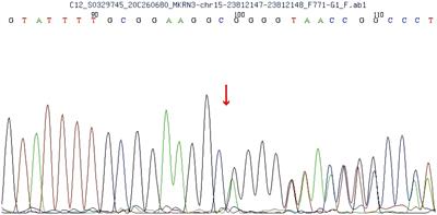 Novel MKRN3 gene mutation associated with central precocious puberty in a Chinese child: a case report